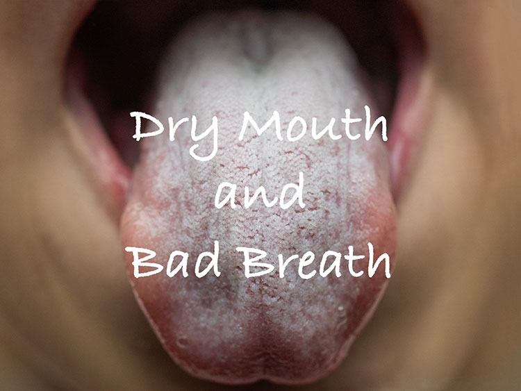 Understanding Bad Breath & Dry Mouth 